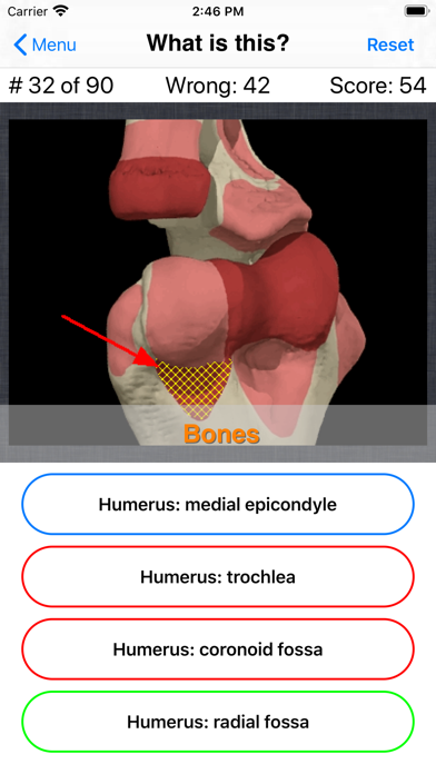 Anatomy Hand Quizのおすすめ画像7