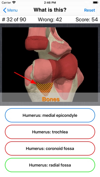 Anatomy Hand Quiz screenshot-6