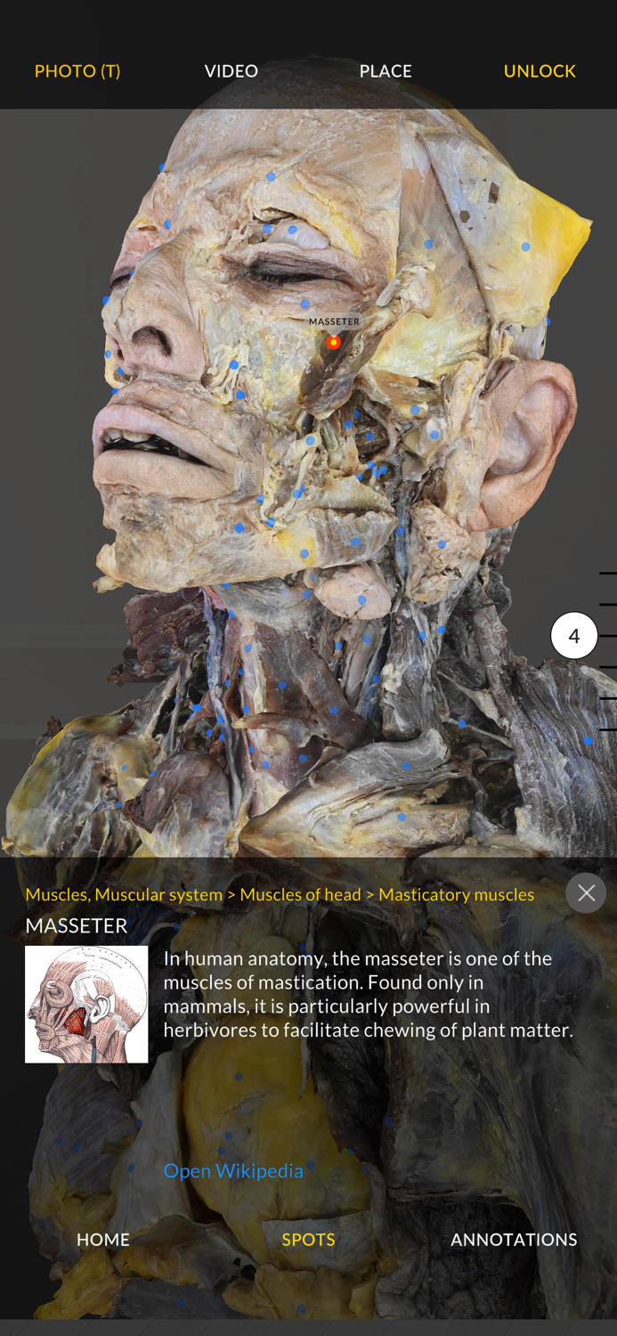 Dissection Master XR