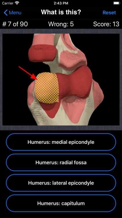 Anatomy Hand Quiz