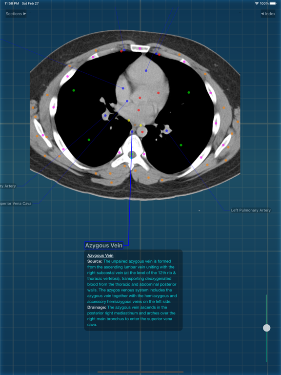 X-Anatomy Proのおすすめ画像4