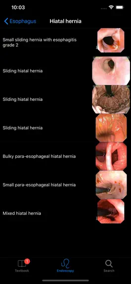 Game screenshot ENDO3® Gastrointestinal Atlas apk