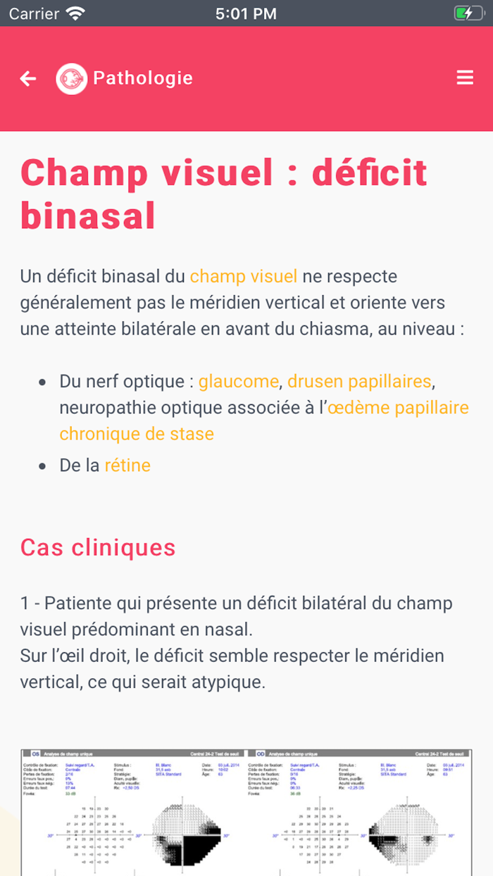 Neuro-Ophtalmologie Pratique