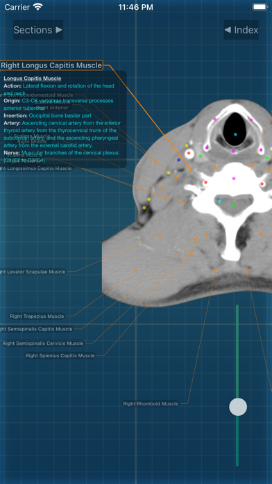 X-Anatomy Proのおすすめ画像10