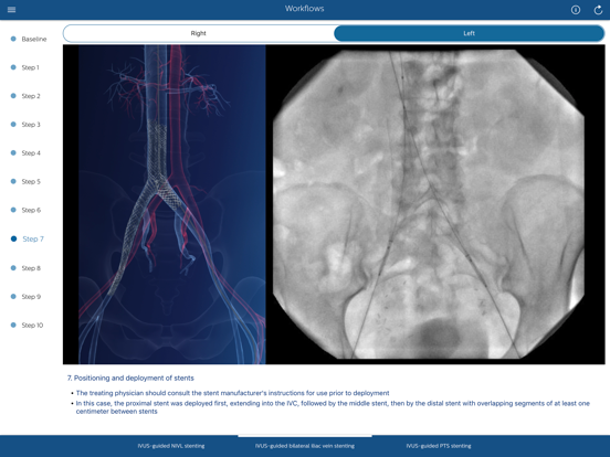 Philips Venous IVUS Tutor iPad screenshot 4 - Medical app
