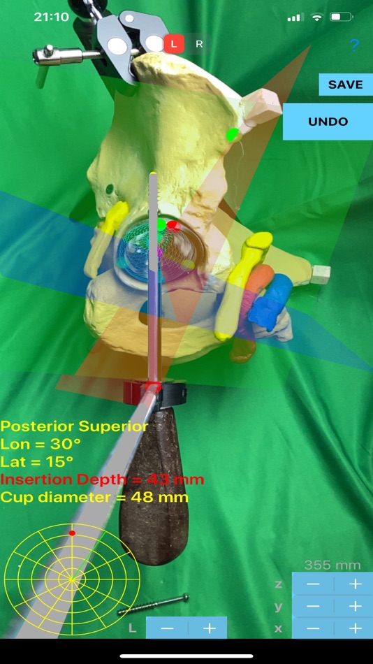 #3. ScrewCupNaviAR (iOS) 由: ORTHOPRACTIS.COM SINGLE MEMBER P.C.