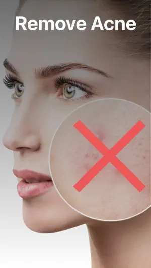 Blemish, Acne, Pimple remover screenshot 3