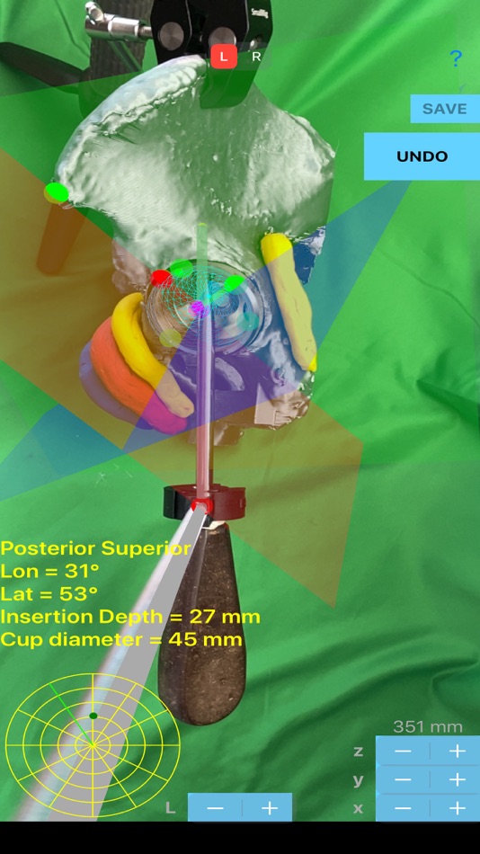 #9. ScrewCupNaviAR (iOS) 由: ORTHOPRACTIS.COM SINGLE MEMBER P.C.