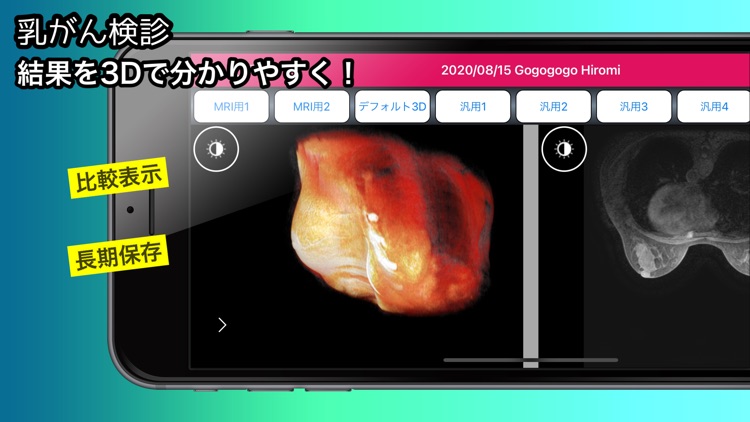 MedalVision Personal Med Image screenshot-6