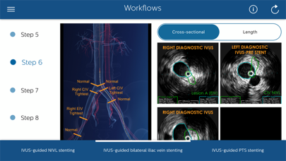 Philips Venous IVUS Tutor Screenshot