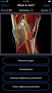 anatomy shoulder quiz iphone screenshot 2