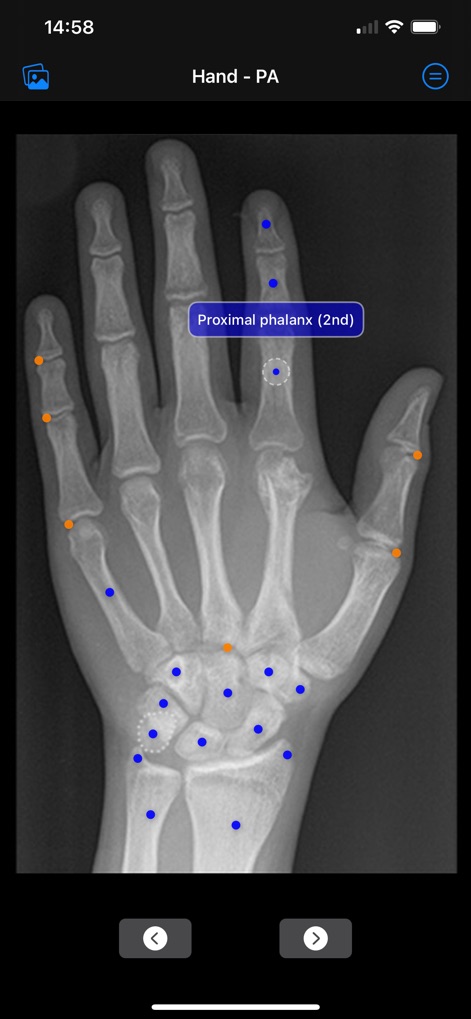 Xray Anatomy - Discover how the app uses color-coded anatomical points and clear labels to identify structures like the 'Proximal phalanx (2nd)' on radiographic images.