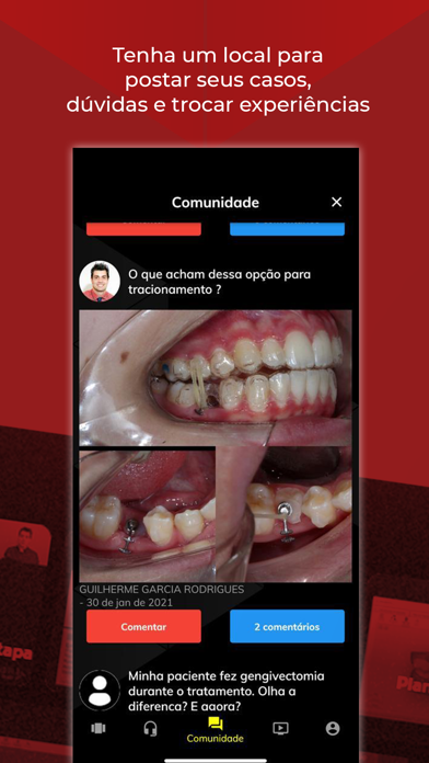 Aligner Play Screenshot