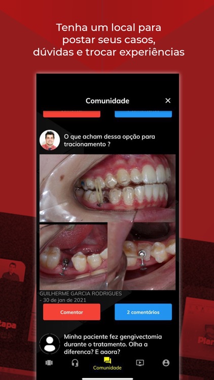 Aligner Play screenshot-6