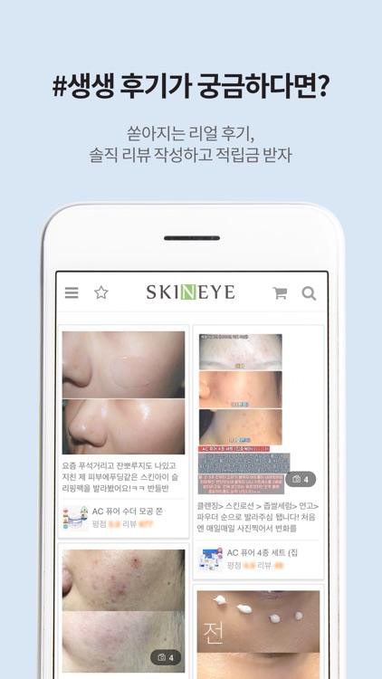 스킨아이 - skineye screenshot-3