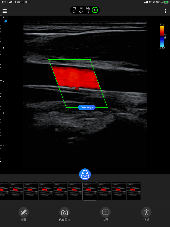 Screenshot #4 pour Stork US