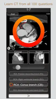 ct passquiz heart / mri iphone screenshot 1