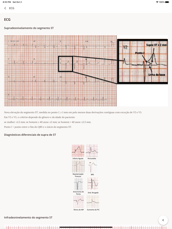 Cardio SCA Score App