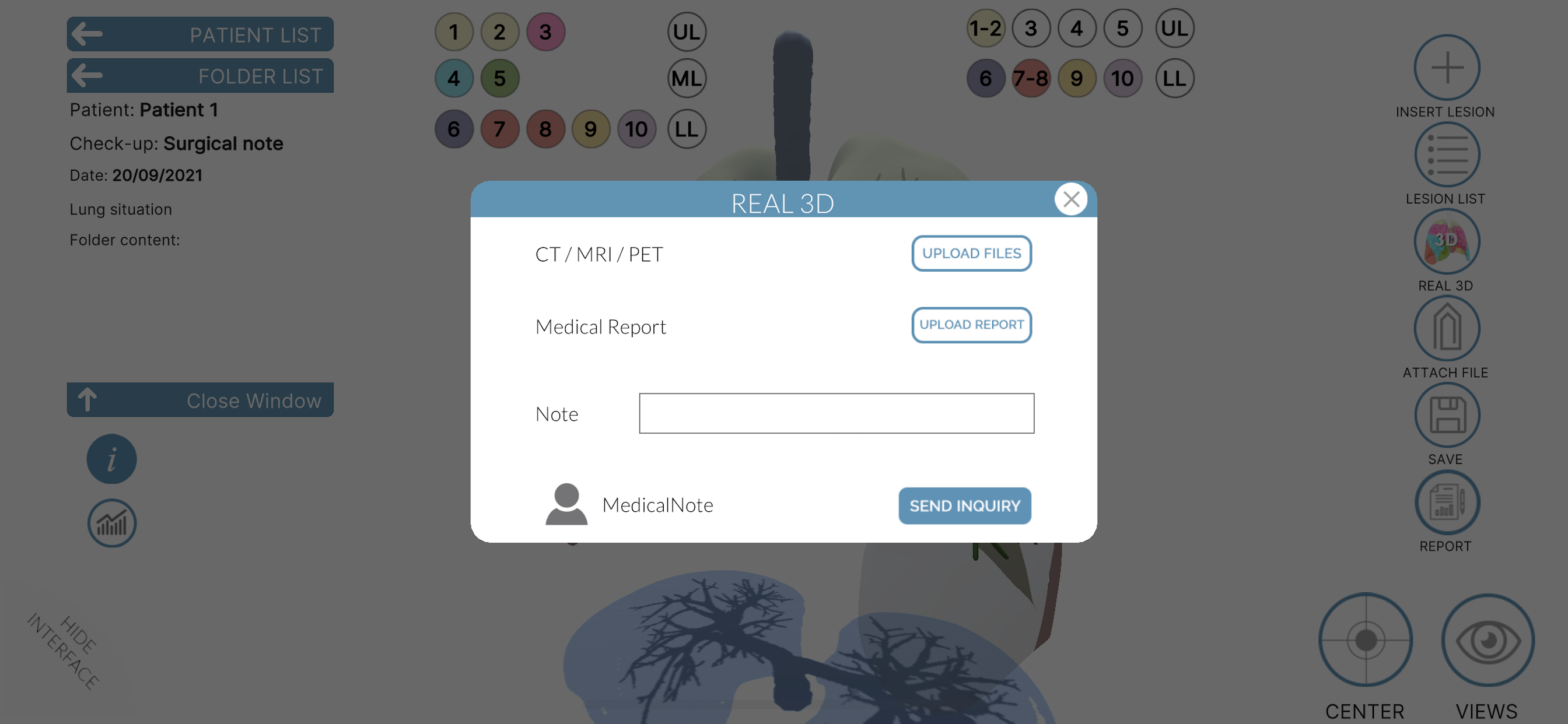 LUNG-NOTE