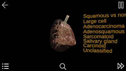 Screenshot #1 pour Non-Small-Cell Lung Cancer