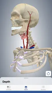 3d cervical dystonia iphone screenshot 2