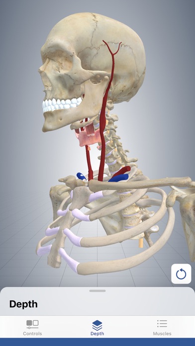 3D Cervical Dystonia Screenshot