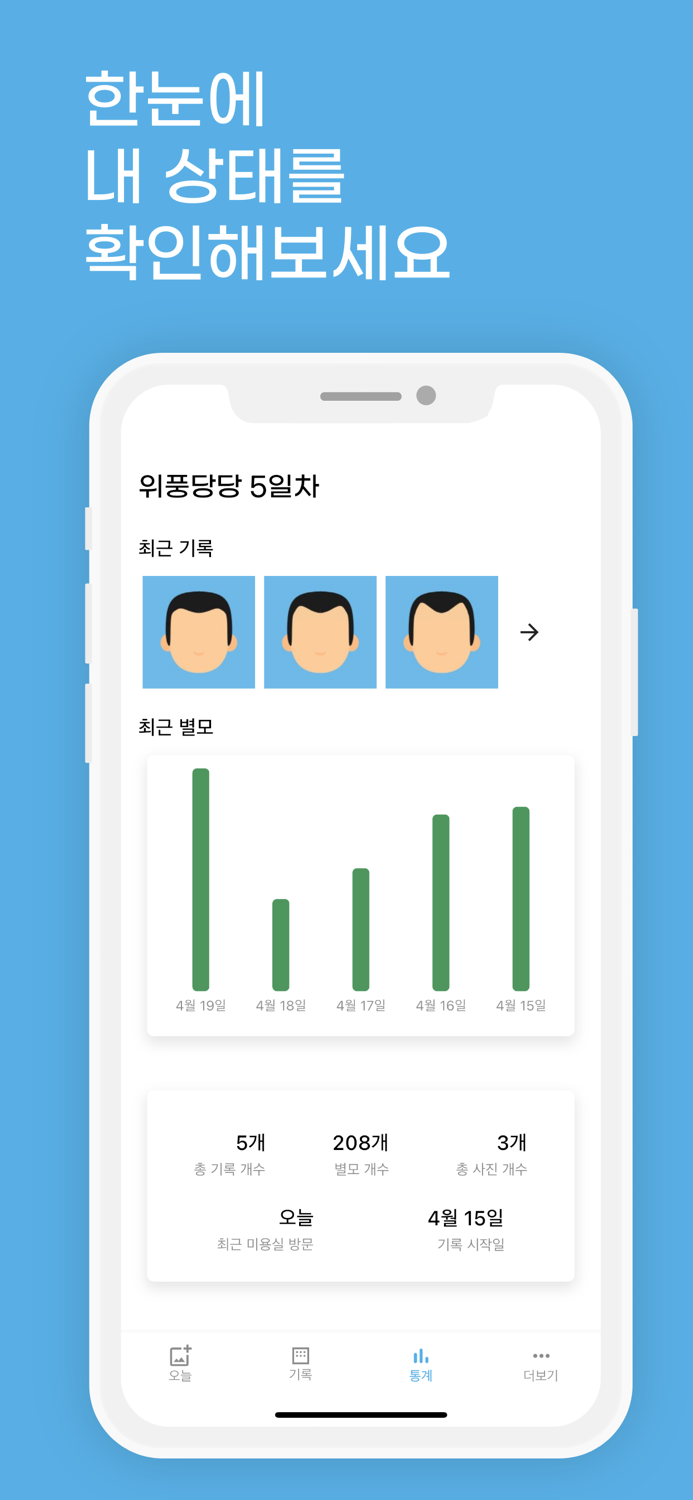 위풍당당 - 머리 사진 기록 탈모 기록