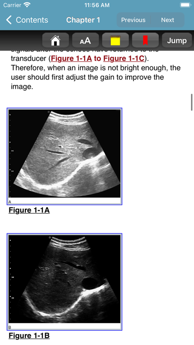 Ma & Mateer's ER Ultrasound 4E Screenshot