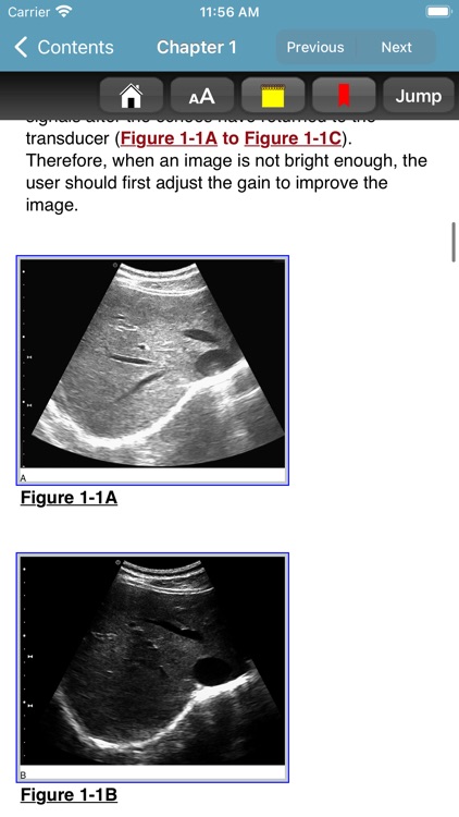 Ma & Mateer's ER Ultrasound 4E screenshot-5
