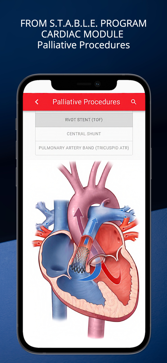 STABLEize for HealthStream
