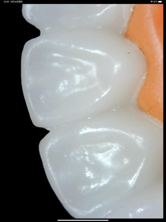 WSPTオーラルカム