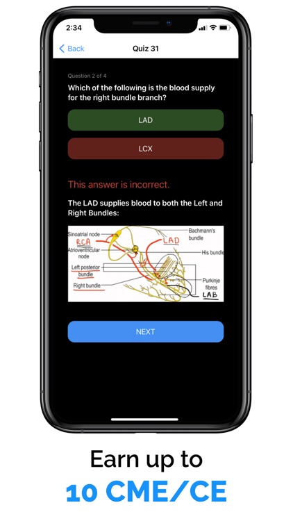 ECG / EKG Explained Clearly screenshot-4