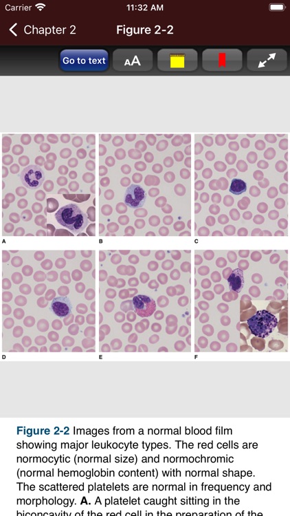 Williams Hematology, 10E screenshot-6