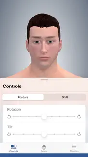 3d cervical dystonia iphone screenshot 1