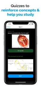 ECG / EKG Explained Clearly screenshot #4 for iPhone