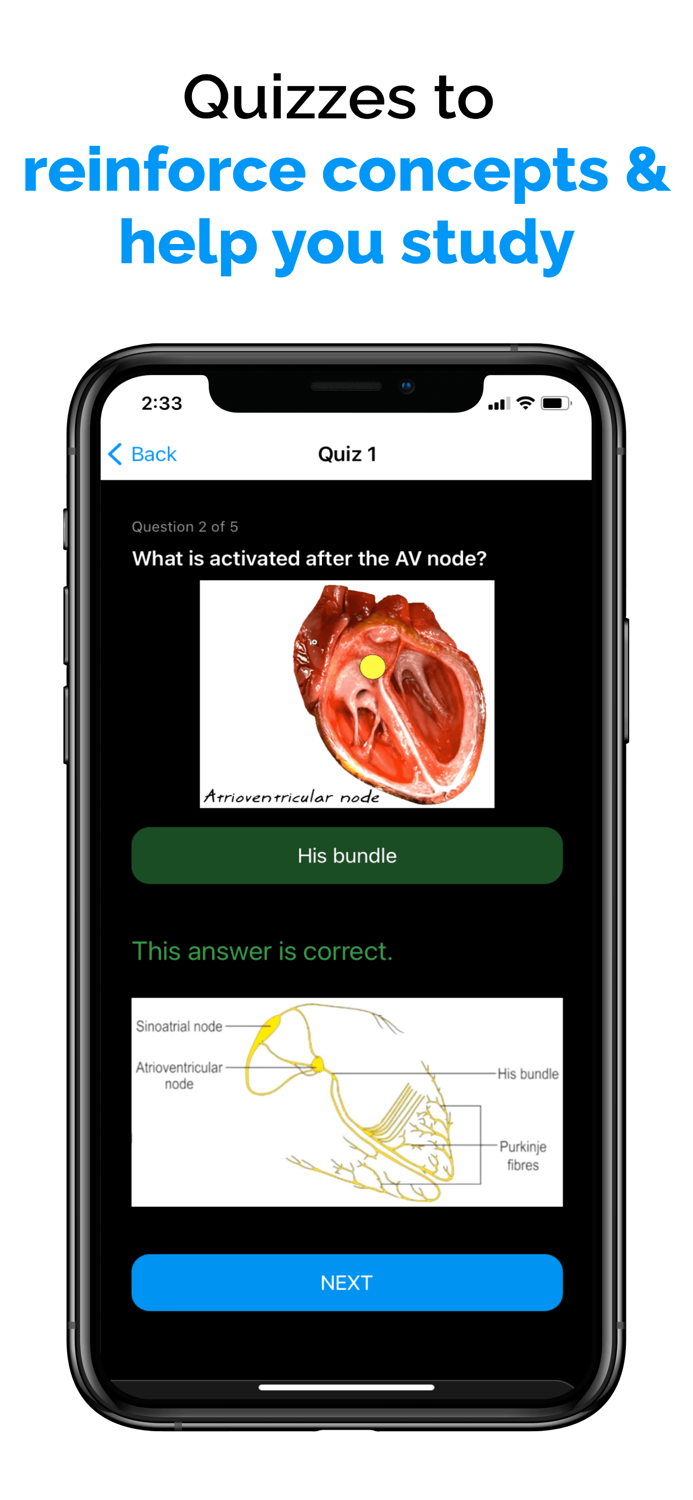 ECG - EKG Explained Clearly