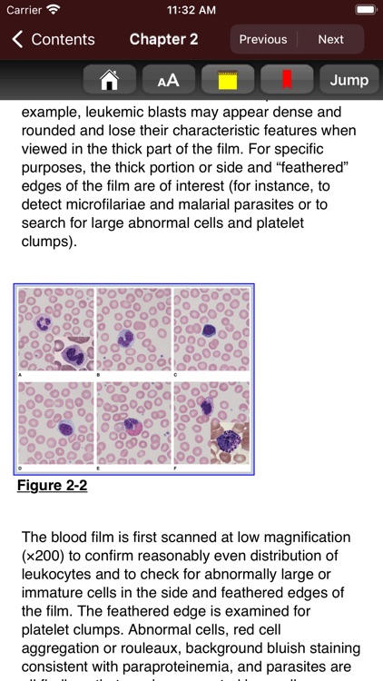 Williams Hematology, 10E screenshot-5