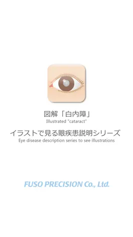 Game screenshot 図解「白内障」イラストで見る眼疾患説明シリーズ mod apk