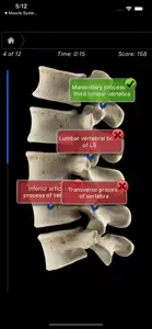 Skeleton System Pro III-iPhone screenshot #1 for iPhone