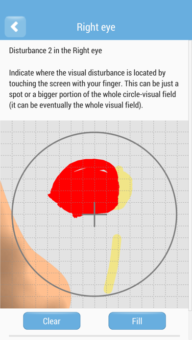 Migraine Aura Screenshot