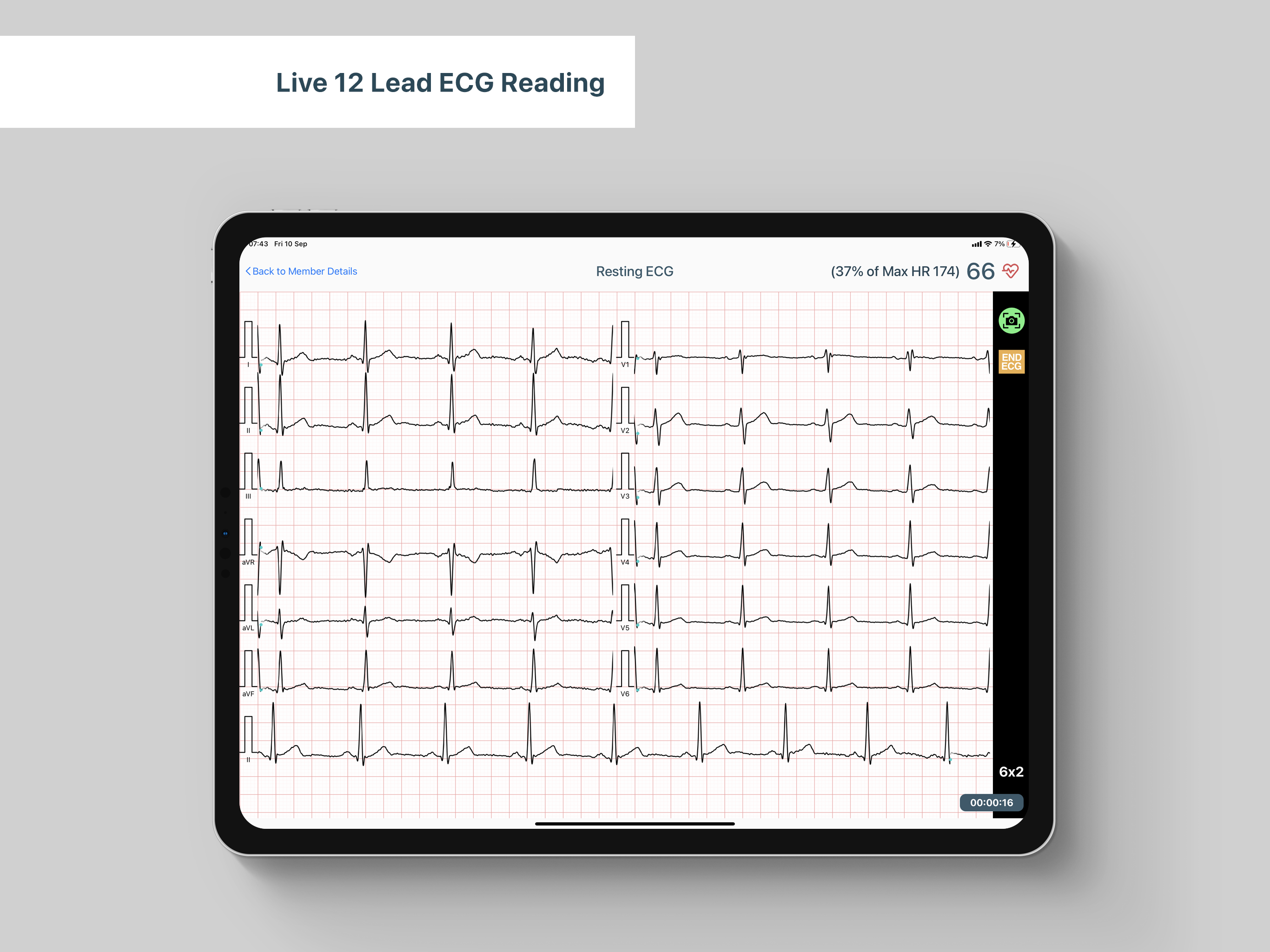 KardioECG screenshot 4