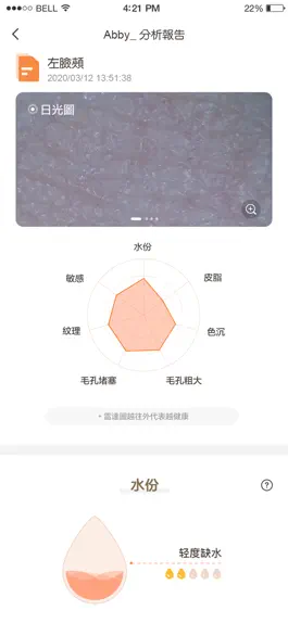 Game screenshot MoreMe水肤镜 hack