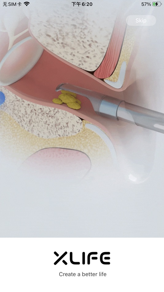 #1. Xlife (iOS) 由: Black Bee Intelligent Manufacturing (Shenzhen) Technology Co., Ltd.