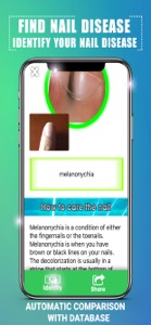 Find Nail Disease screenshot #3 for iPhone