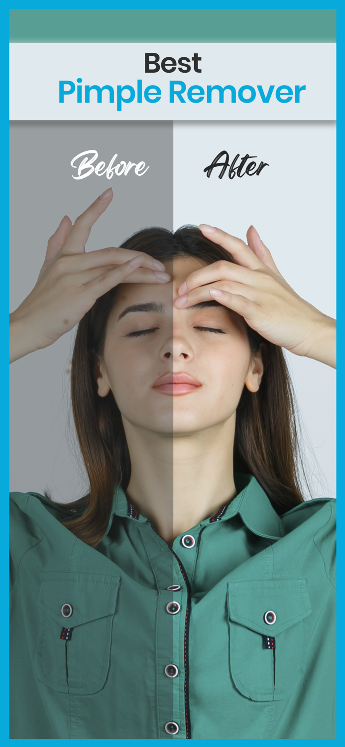 Blemish editor Pimple Remover