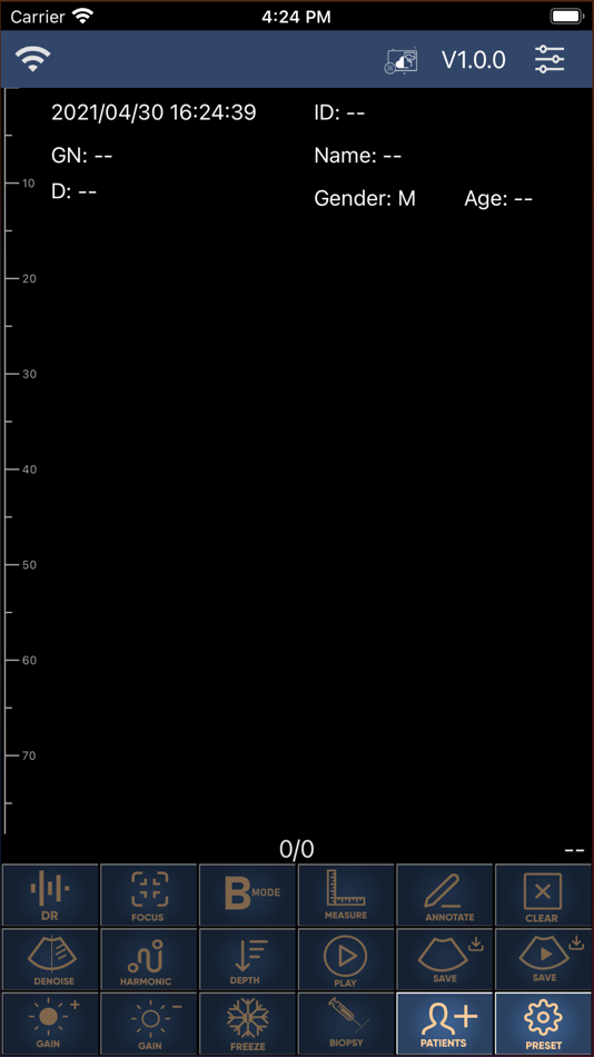 Sonoque (iOS) 由: O2Lifecare