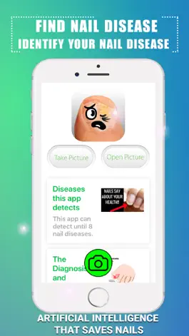 Game screenshot Найдите болезнь ногтей mod apk