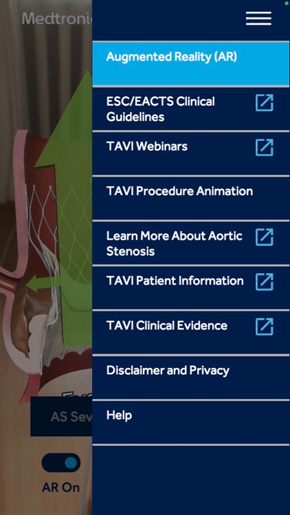Aortic Stenosis Evolut™ TAVI