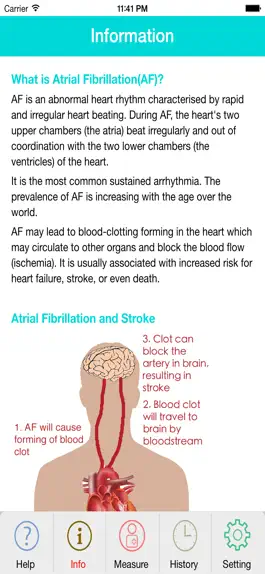 Game screenshot Photo AFib Detector hack