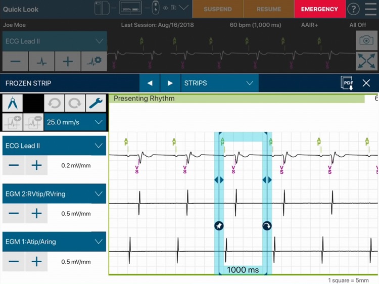 CareLink SmartSync™ CARIB screenshot-4